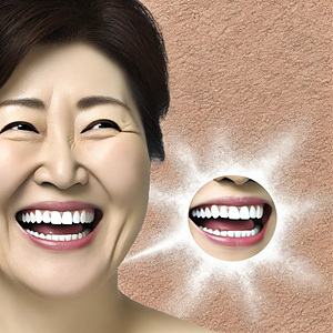 사랑니 발치 옆 치아 시림 한달